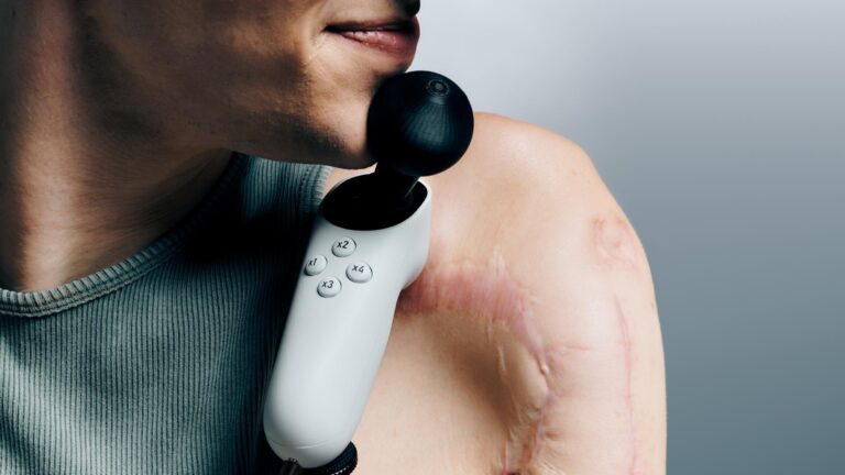 Xbox chin-operated adaptive joystick